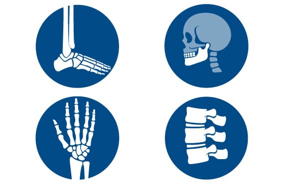 Ostenil-mini-rheumatologie-arthrose-injektion-hyaluronsaure-block-570×370